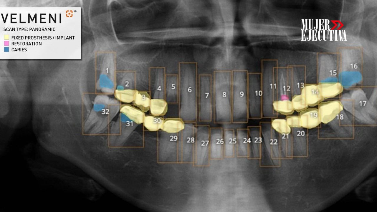 Velmeni: la Inteligencia Artificial capaz de detectar patologías en radiografías dentales