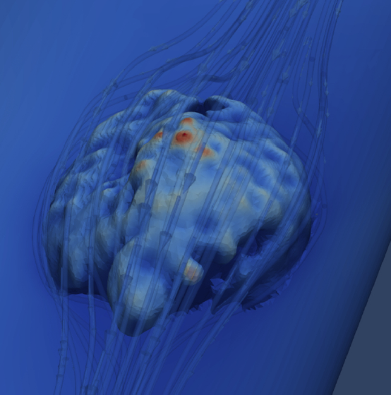 Cálculo computacional de esfuerzos en un trombo utilizando geometría real obtenida por microscopía confocal